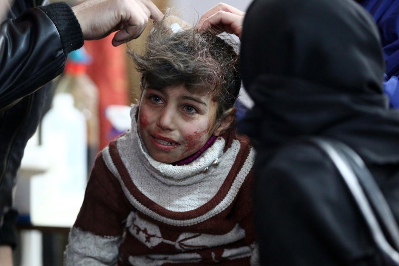 Hala, 9, receives treatment at a makeshift hospital following Syrian government bombardments on rebel-held town of Saqba, in the besieged Eastern Ghouta region on the outskirts of the capital Damascus on February 22, 2018. / AFP PHOTO / AMER ALMOHIBANY (Photo credit should read AMER ALMOHIBANY/AFP/Getty Images)